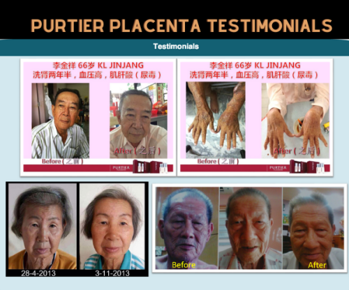 Purtier Placenta Testimonials - Nhân chứng sống